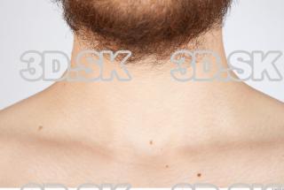 Neck texture of Charlie 0002